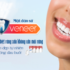 Dán Sứ Đẹp Tự Nhiên tại Nha Khoa LEVA