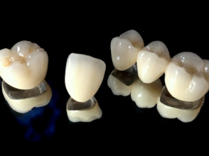 Răng Sứ-Kim Loại Thẩm Mỹ