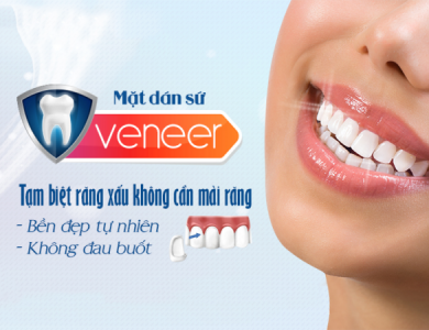 Dán Sứ Đẹp Tự Nhiên tại Nha Khoa LEVA